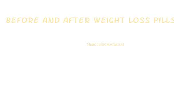 Before And After Weight Loss Pills