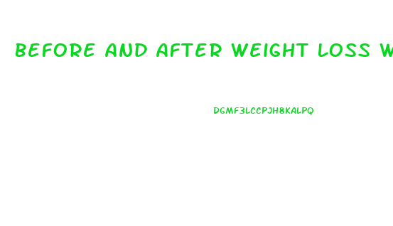 Before And After Weight Loss With So So Diet