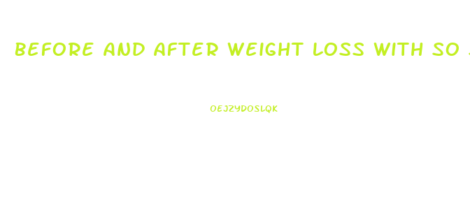 Before And After Weight Loss With So So Diet