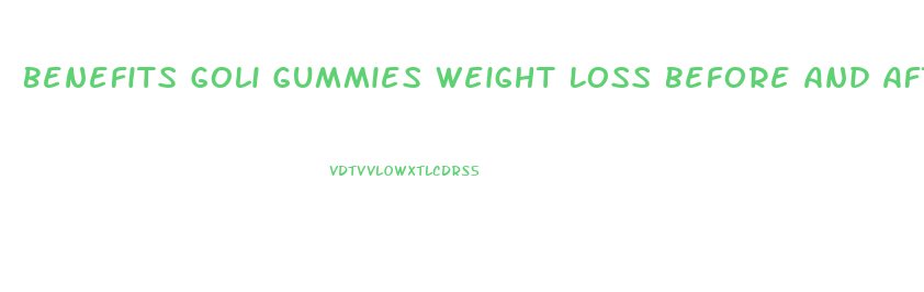 Benefits Goli Gummies Weight Loss Before And After