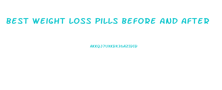 Best Weight Loss Pills Before And After