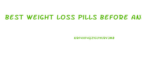 Best Weight Loss Pills Before And After