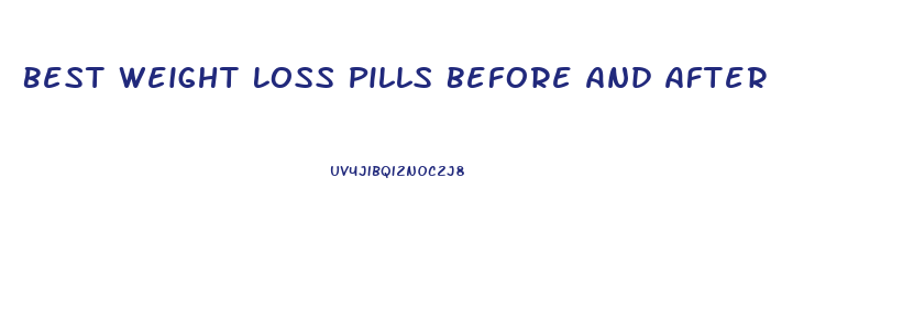 Best Weight Loss Pills Before And After