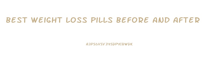 Best Weight Loss Pills Before And After