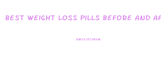 Best Weight Loss Pills Before And After