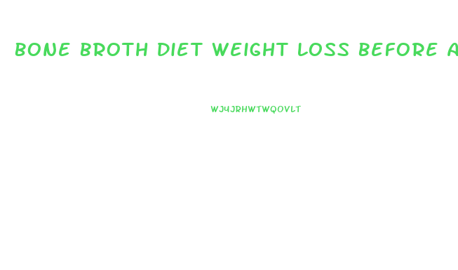 Bone Broth Diet Weight Loss Before And After