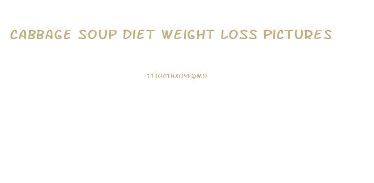 Cabbage Soup Diet Weight Loss Pictures
