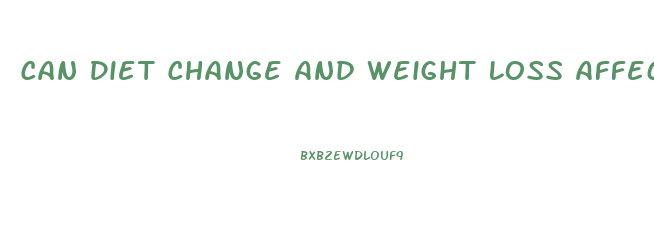 Can Diet Change And Weight Loss Affect Your Thyroid