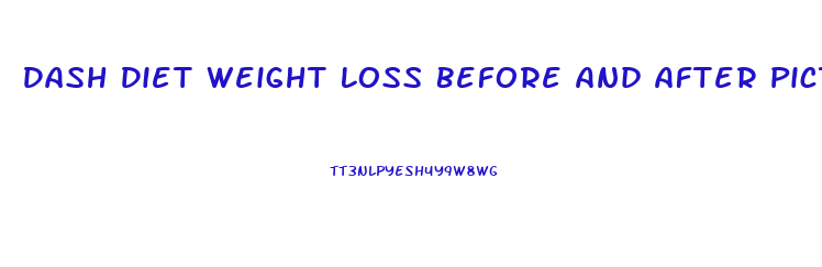 Dash Diet Weight Loss Before And After Pictures