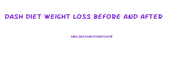 Dash Diet Weight Loss Before And After