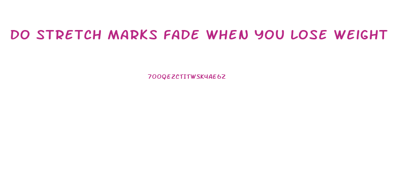 Do Stretch Marks Fade When You Lose Weight