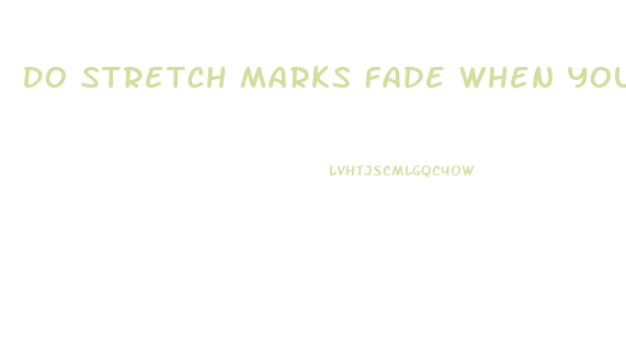 Do Stretch Marks Fade When You Lose Weight