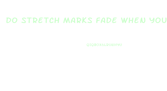 Do Stretch Marks Fade When You Lose Weight