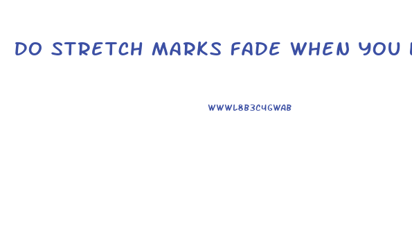 Do Stretch Marks Fade When You Lose Weight