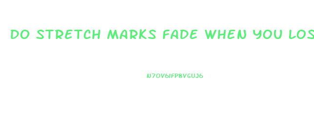 Do Stretch Marks Fade When You Lose Weight