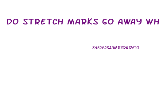 Do Stretch Marks Go Away When You Lose Weight