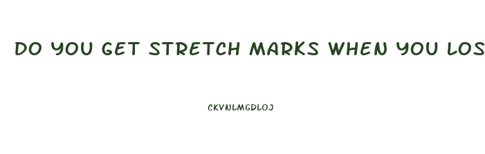 Do You Get Stretch Marks When You Lose Weight