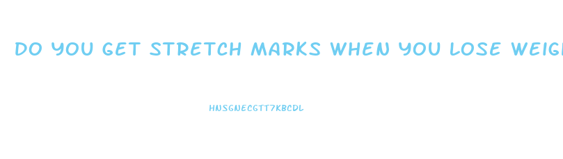 Do You Get Stretch Marks When You Lose Weight