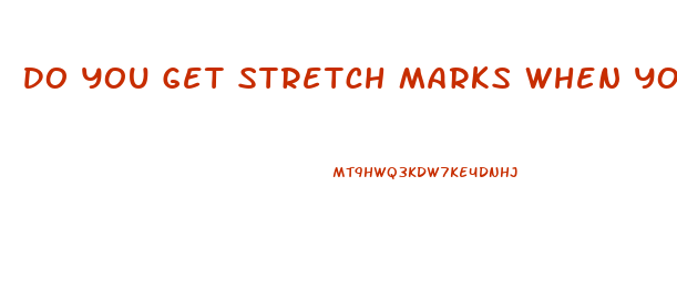 Do You Get Stretch Marks When You Lose Weight