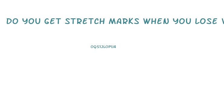 Do You Get Stretch Marks When You Lose Weight