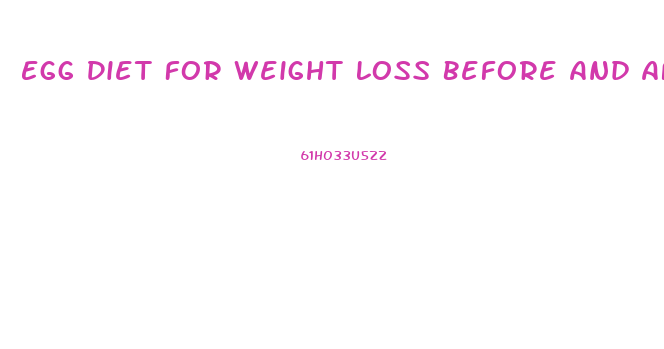 Egg Diet For Weight Loss Before And After