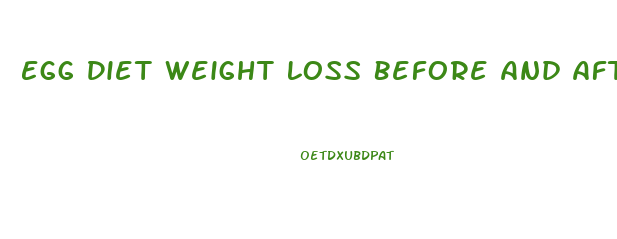 Egg Diet Weight Loss Before And After