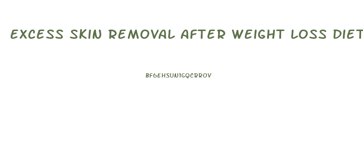 Excess Skin Removal After Weight Loss Diet