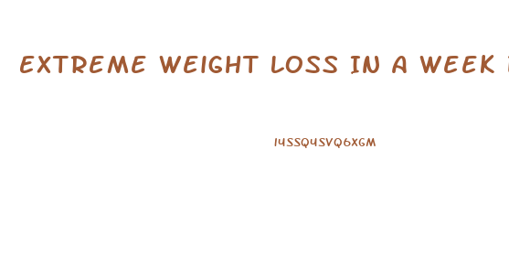 Extreme Weight Loss In A Week Diet