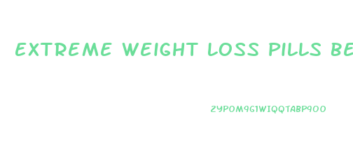 Extreme Weight Loss Pills Before And After