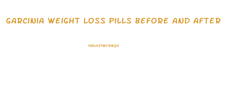 Garcinia Weight Loss Pills Before And After