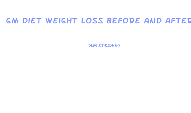 Gm Diet Weight Loss Before And After