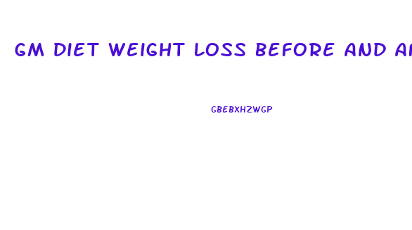 Gm Diet Weight Loss Before And After