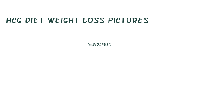 Hcg Diet Weight Loss Pictures