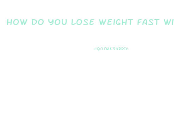 How Do You Lose Weight Fast Without Working Out And Diet Pills