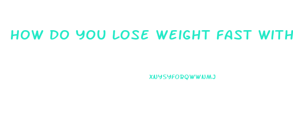 How Do You Lose Weight Fast Without Working Out And Diet Pills