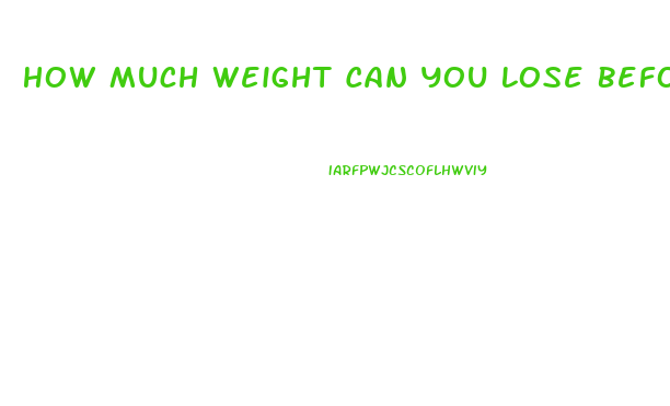 How Much Weight Can You Lose Before You Die