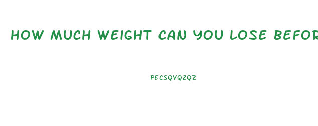 How Much Weight Can You Lose Before You Die