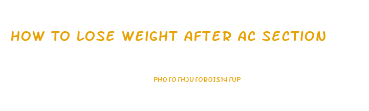 How To Lose Weight After Ac Section