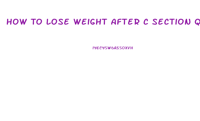 How To Lose Weight After C Section Quickly