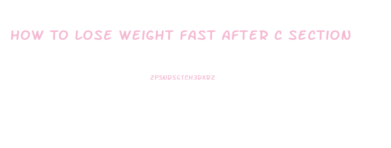 How To Lose Weight Fast After C Section