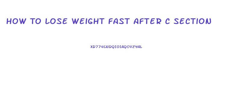 How To Lose Weight Fast After C Section