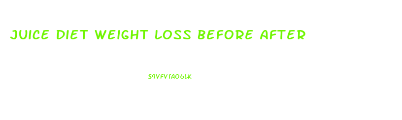 Juice Diet Weight Loss Before After