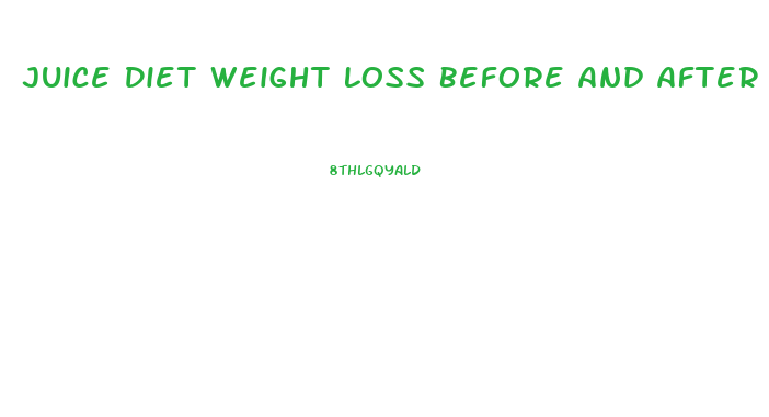 Juice Diet Weight Loss Before And After
