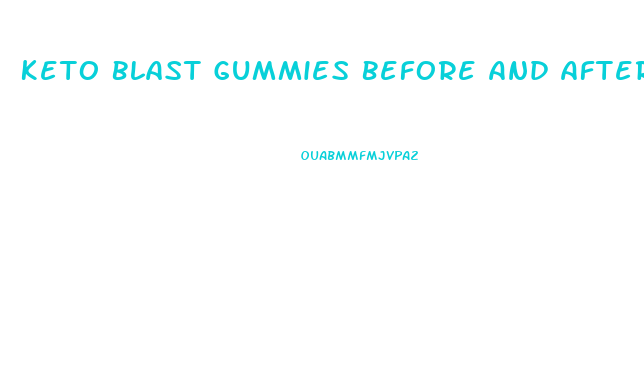 Keto Blast Gummies Before And After