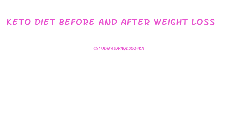 Keto Diet Before And After Weight Loss