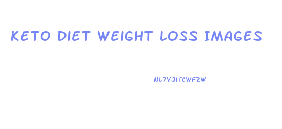 Keto Diet Weight Loss Images