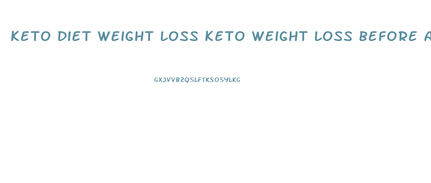 Keto Diet Weight Loss Keto Weight Loss Before And After