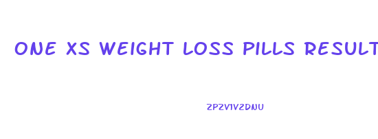 One Xs Weight Loss Pills Results