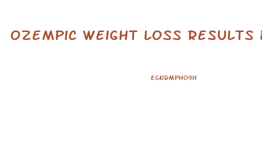 Ozempic Weight Loss Results Best Diet