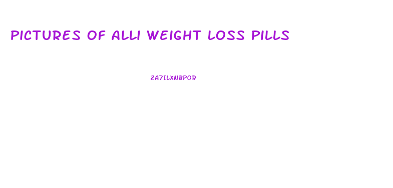 Pictures Of Alli Weight Loss Pills